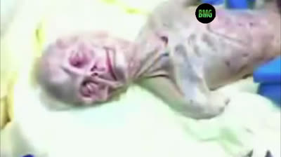 AUTOPSIA EM UM ALIEN
